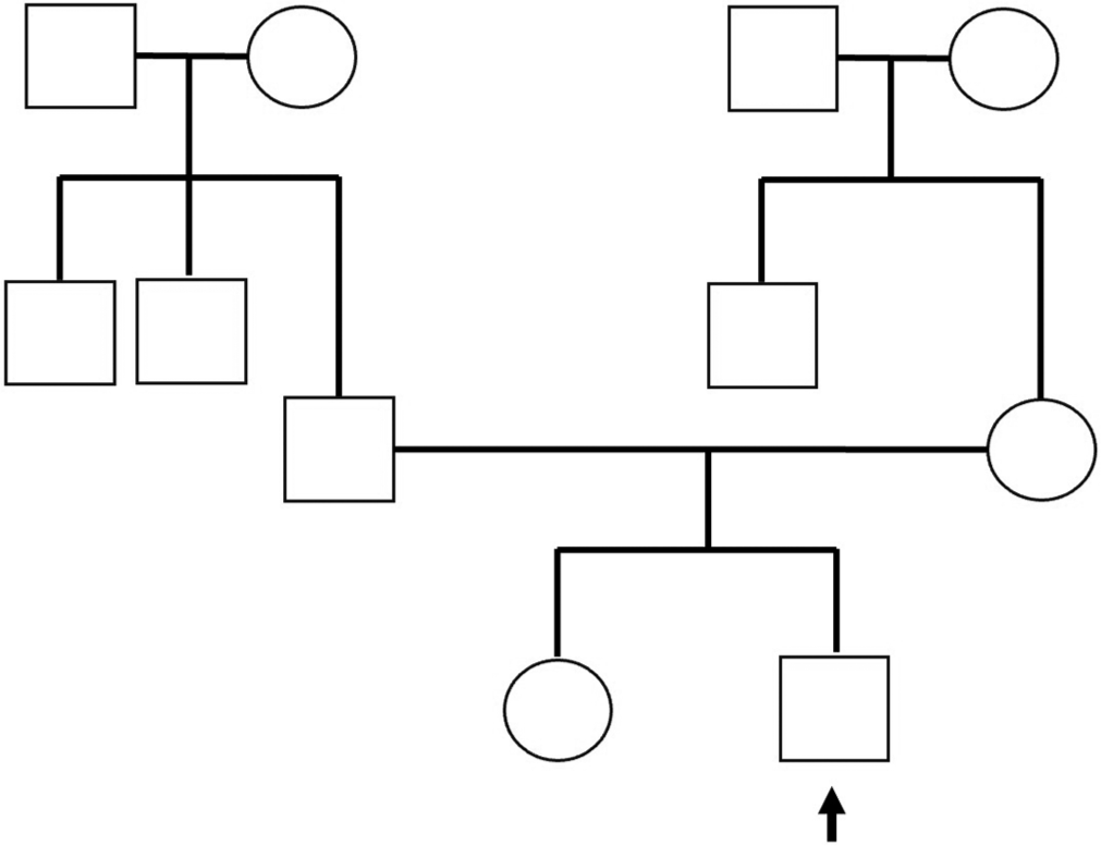 Three generation pedigree chart (arrow mark-proband under examination).